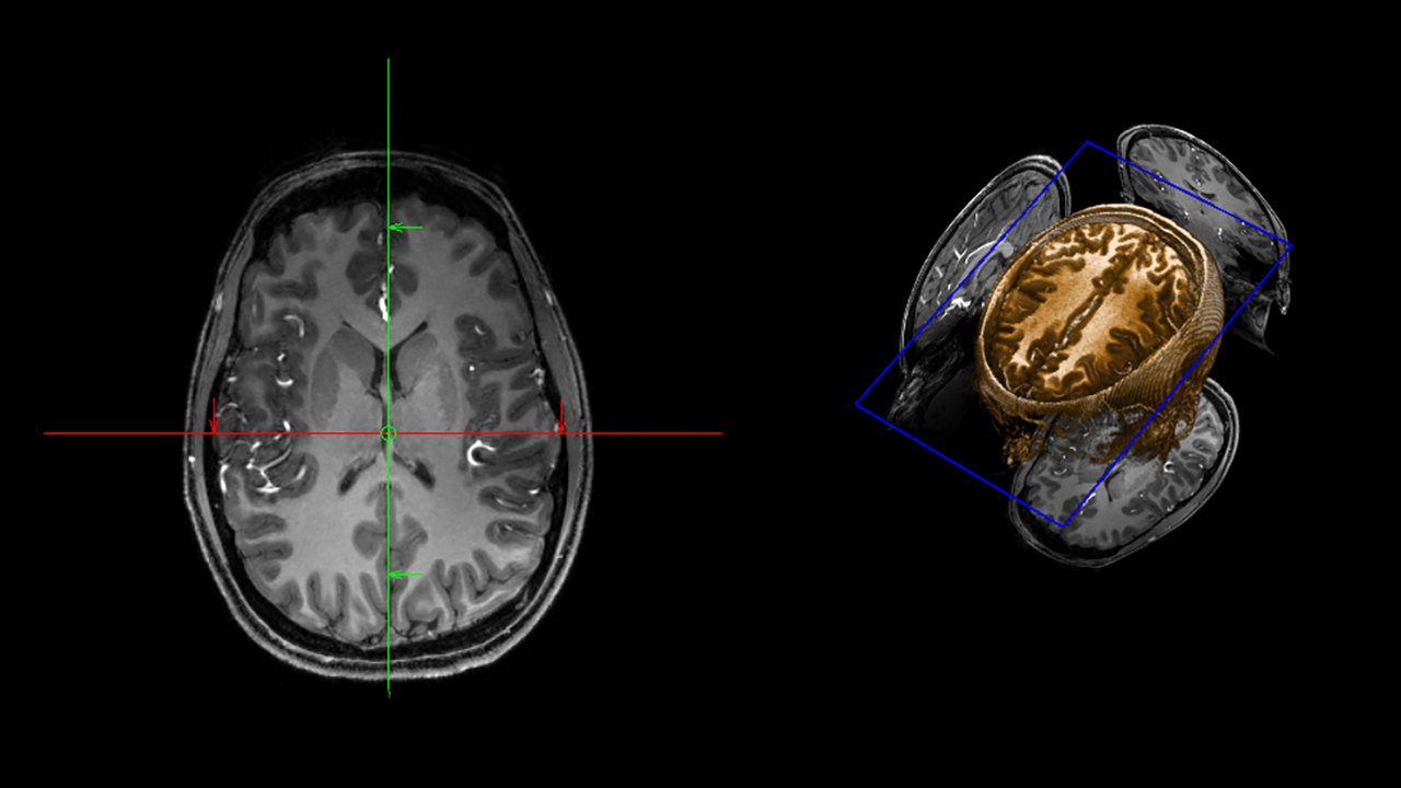 Brain scan image provided by the MRI Research Center