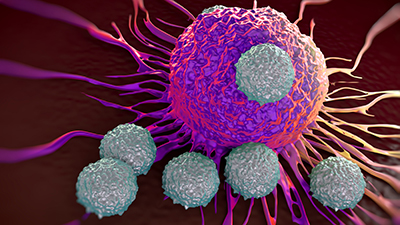 An artist's rendering of cancer cells is pictured.